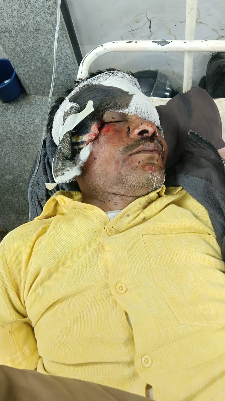 Lucknow News: उल्टी दिशा से आ रही बाइक से टकराकर दो घायल