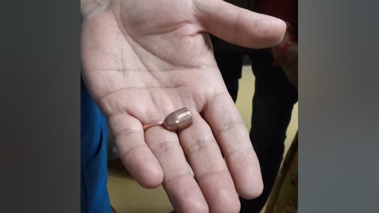 लुधियाना में कारोबारी को मारी गोली: बाजू से खून बहने पर मचाया शोर, दोस्त के घर जाते समय हुआ हमला