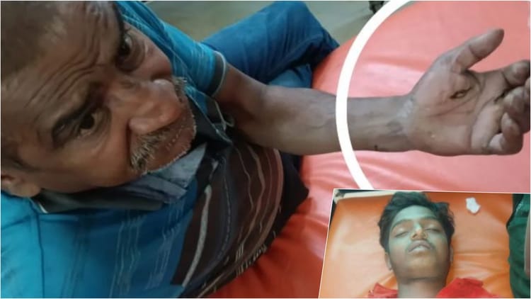 Umaria News: बिजली सप्लाई शुरू होते ही करंट की चपेट में आया युवक, दर्दनाक मौत, बचाने दौड़े पड़ोसी भी झुलसे