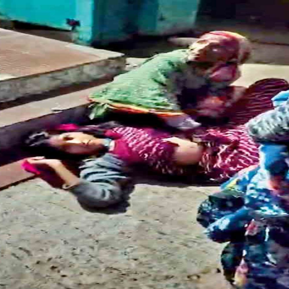 प्राथमिक स्वास्थ्य केंद्र शिवना में ताला लगा मिला:डॉक्टर और नर्स गायब, प्रसूता बाहर तड़पती रही, सीढ़ियों पर हुआ प्रसव