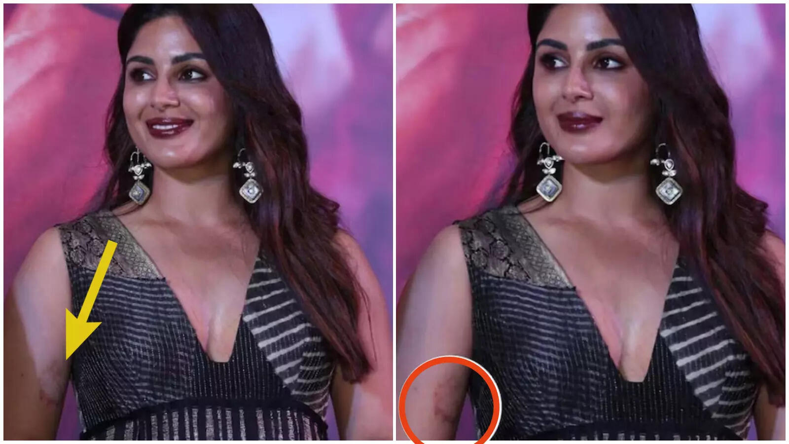 संयुक्‍ता मेनन की बांह पर ये निशान कैसा? फैंस हैरान-परेशान! कोई बता रहा एलर्जी तो कोई लव बाइट