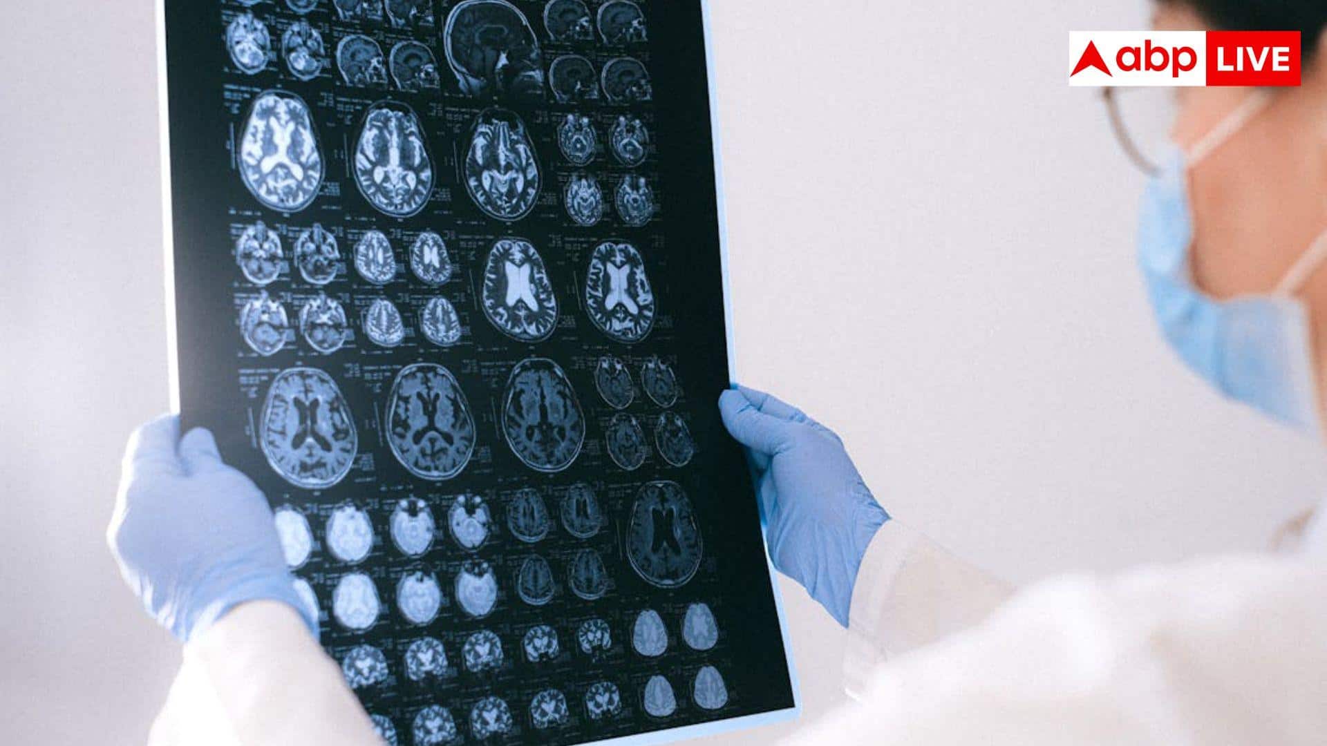 30 की उम्र में क्यों बढ़ रहा है ब्रेन फॉग? डॉक्टर ने बताए इसके कारण और बचाव के तरीके