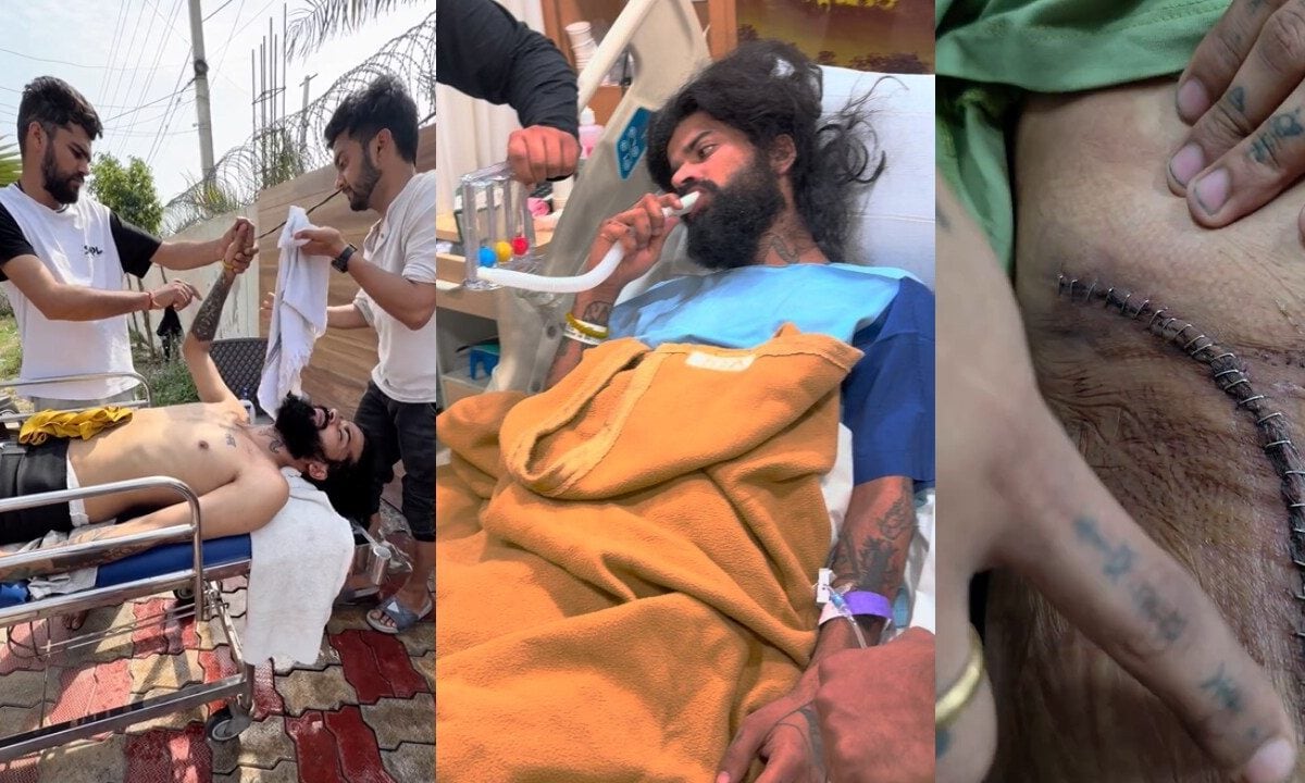 अनुराग डोभाल ने दिखाए चोट के निशान, लगे लंबे टांके, पूछा-‘नई जिंदगी की शुरुआत देखोगे?’