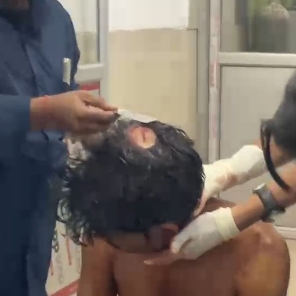 फर्रुखाबाद में शराब के नशे में भाई ने की मारपीट:पत्नी को बचाने आई भाभी भी घायल, अस्पताल में भर्ती