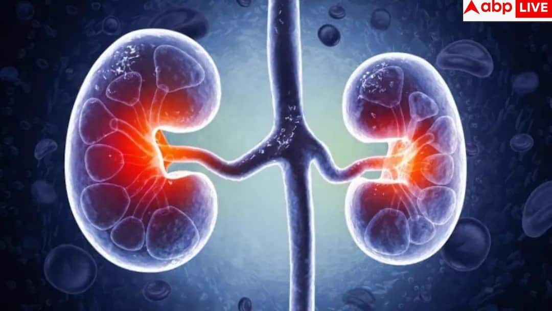 Kidney Disease Symptoms: किडनी की बीमारी है 'साइलेंट किलर', डॉक्टर से जानें वे शुरुआती लक्षण जो बचा सकते हैं आपकी जान