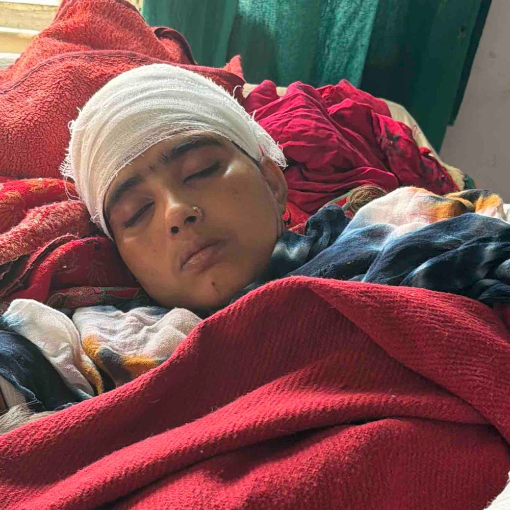 रामपुर में भाभी पर देवर-देवरानी का जानलेवा हमला:गाली-गलौज से मना करने पर लांबा खेड़ा में घर में घुसकर किया वार