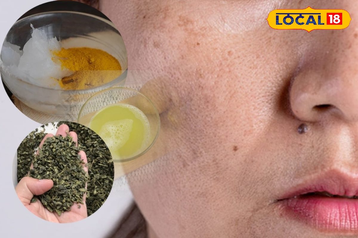 ग्लोइंग स्किन का सीक्रेट! डार्क सर्कल्स और दाग-धब्बों को कहें अलविदा, अपनाएं ये आसान घरेलू नुस्खे