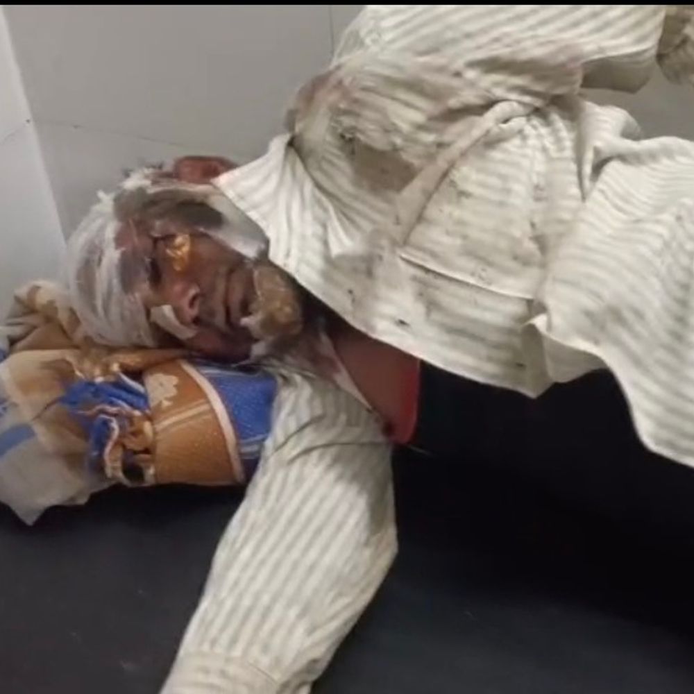 उमरिया में खड़े ट्रक से टकराई बाइक:दो लोग घायल, एक के चेहरे सिर पर चोट; जिला अस्पताल में भर्ती