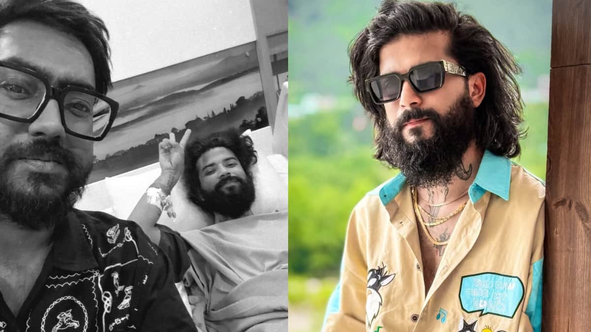 आईसीयू से बाहर आए अनुराग डोभाल, मैनेजर रोहित पांडे ने सोशल मीडिया पर शेयर की पहली तस्वीर