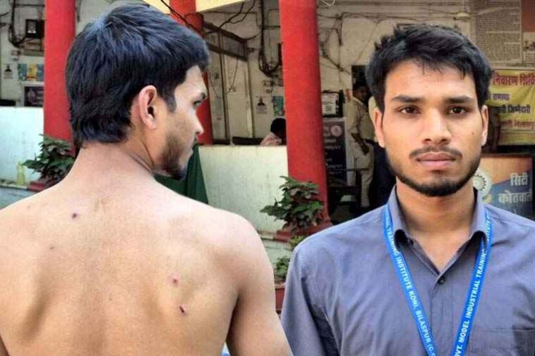 बाइक टकराने की मामूली घटना पर आईटीआई छात्र पर बदमाशों ने किया जानलेवा हमला, चेहरे और पीठ पर आई गंभीर चोटें, जांच में जुटी पुलिस