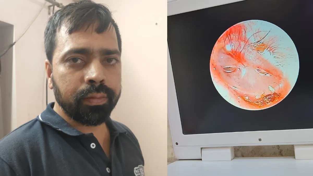 खाकी की हैवानियत: पत्नी की शिकायत पर पुलिस ने पति को बेरहमी से पीटा, फाड़ दिया कान का पर्दा