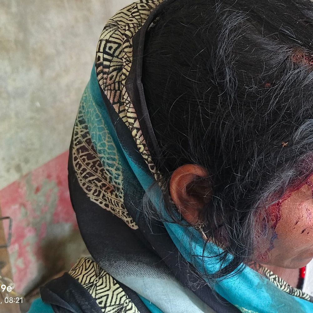 पति को प्रेमिका से साथ आपत्तिजनक हालत में पकड़ा:श्रावस्ती में गुस्साए पति ने पत्नी पर ईंट से किया हमला, सिर फट; जांच में जुटी पुलिस