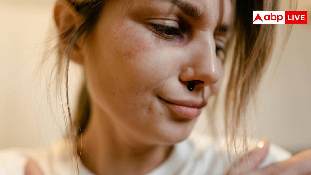 Nose Bleeding: गर्मियां शुरू होते ही नाक से निकलने लगता है खून, जानें कब नॉर्मल और कब है टेंशन लेने की जरूरत?