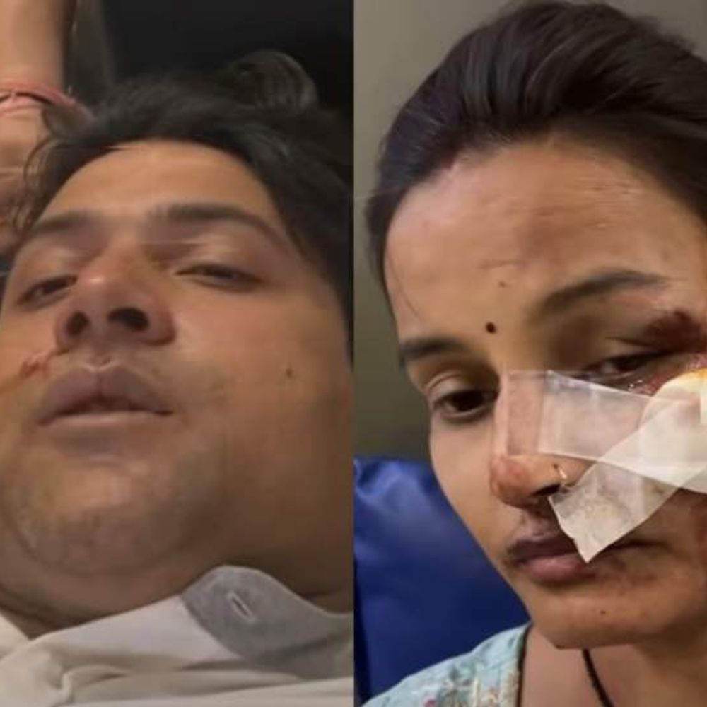 कार ने बाइक सवार परिवार को मारी टक्कर:सड़क पर गिरे दंपती और दो बच्चियां घायल, चालक फरार; सत्य साईं चौराहे के पास हादसा